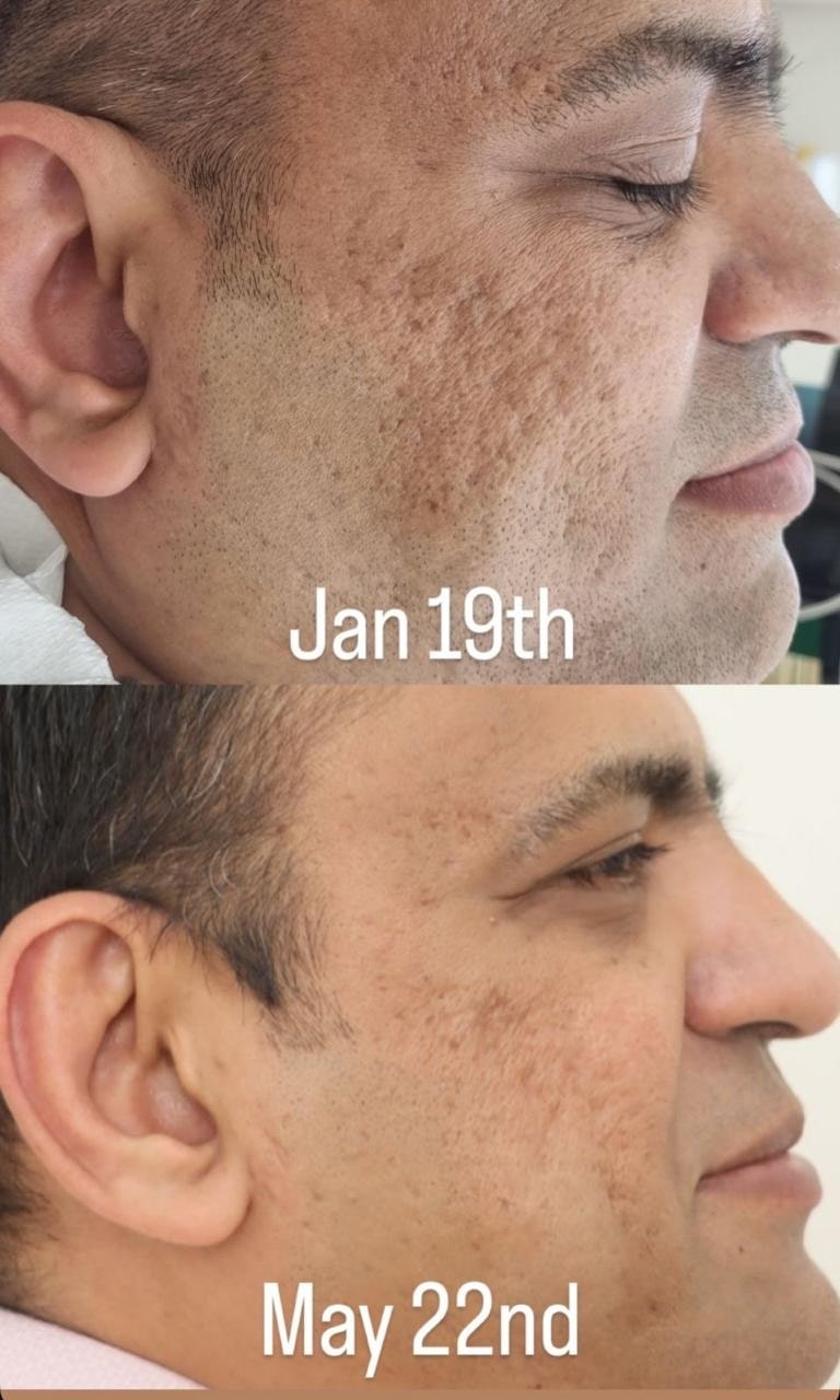 Patient success story and treatment results